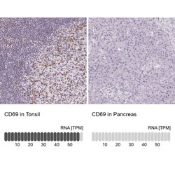 CD69 Antibody, Novus Biologicals 25 &mu;L, Unlabeled:Antibodies, Polyclonal